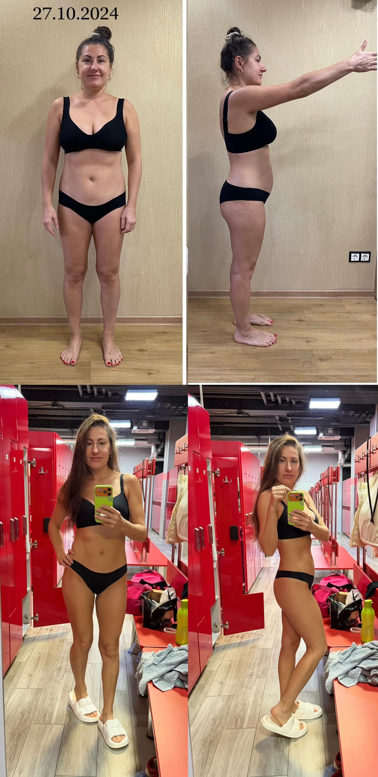 Коллаж Тони до и после: фотографии спереди и сбоку